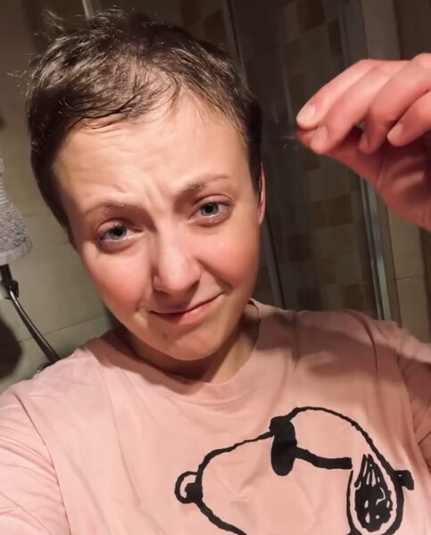 Anička SLováčková ukázala, jak jí potřetí vypadávají vlasy. Foto: IG
