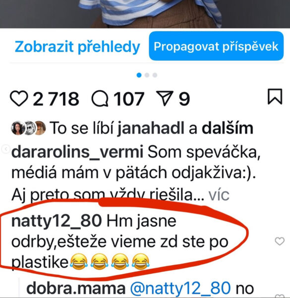 Jedna z žen napsala, že Dara má hezkou pleť díky plastice.