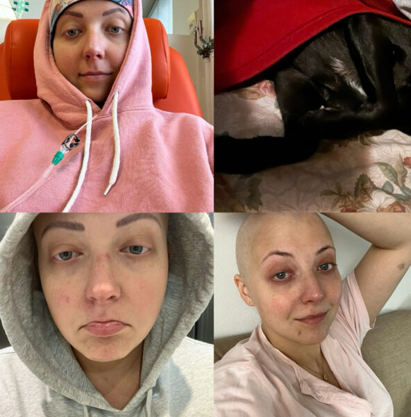 Anička Slováčková se už rok léčí s rakovinou plic.