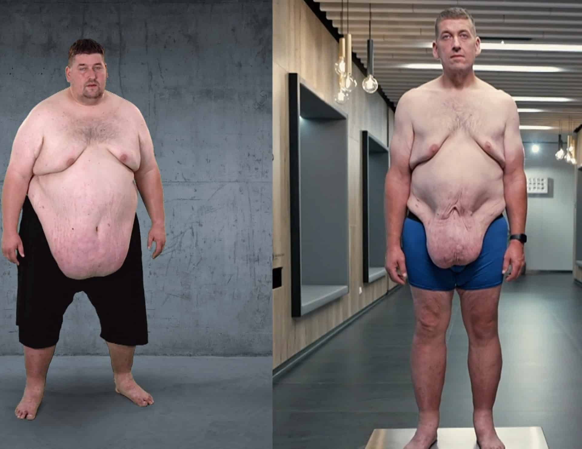 Na konci Extrémních proměn Lukáše trápila převislá kůže. Zdroj: Nova