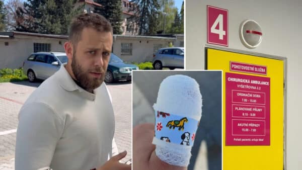 Vincent Navrátil si usekl kus palce, musel do jablonecké nemocnice.