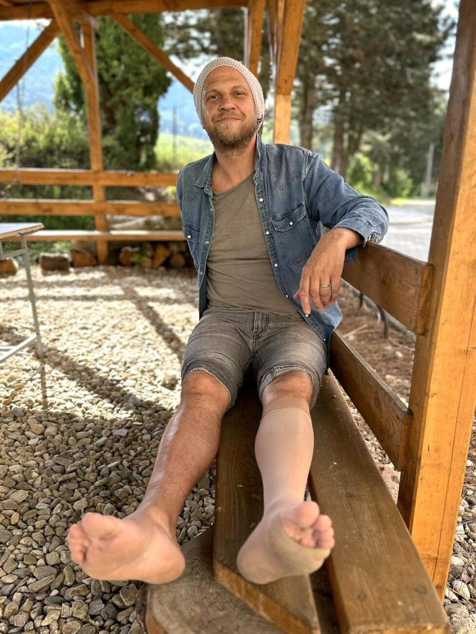 Tomáš Polák z kapely O5 a Radeček m zdravotní problém s nohou.