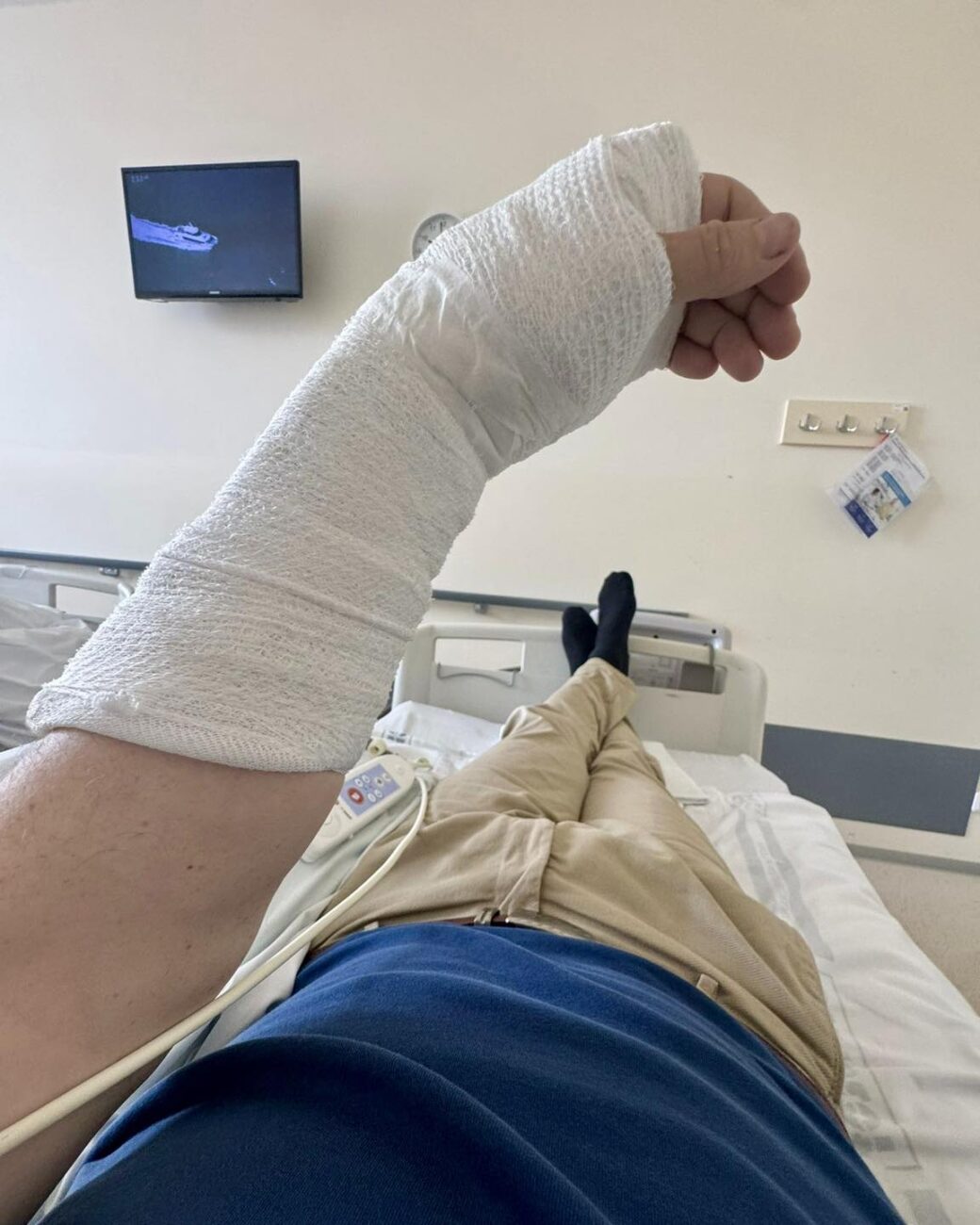 Liberecký hejtman Martin Půta si zlomil ruku.