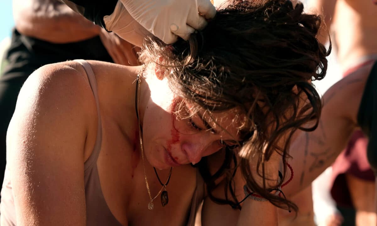 Sára se při hře v Survivoru zranila na hlavě. Foto: TV Nova