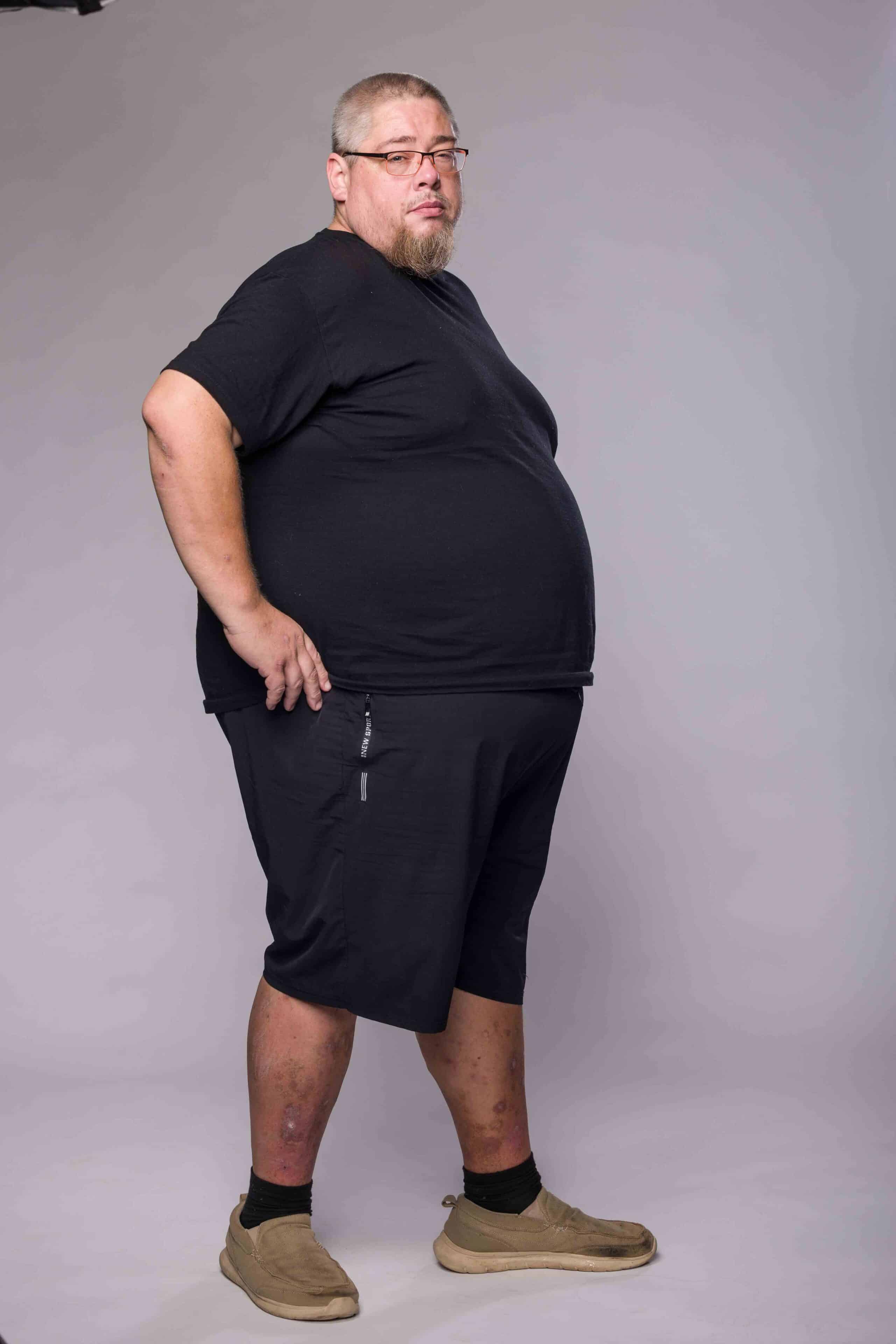 Extrémní proměny: Honza vážil 197 kilo. Foto: TV Nova