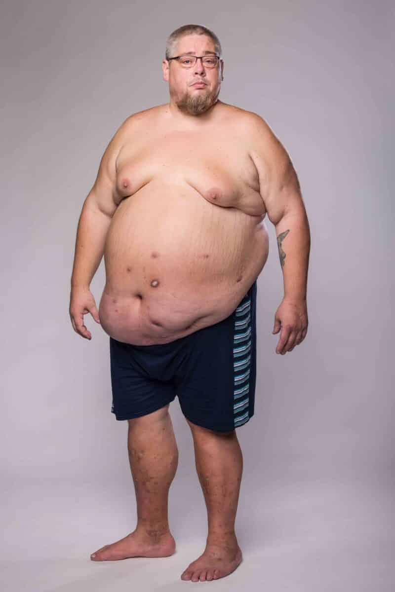 Extrémní proměny: Honza vážil 197 kilo. Foto: TV Nova