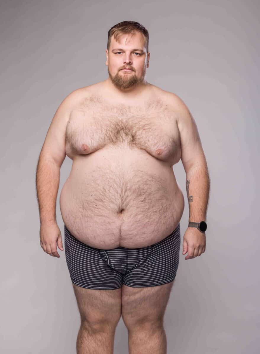 170kilový Matěj Černý v pořadu Extrémní proměny. Foto: TV Nova (se souhlasem)