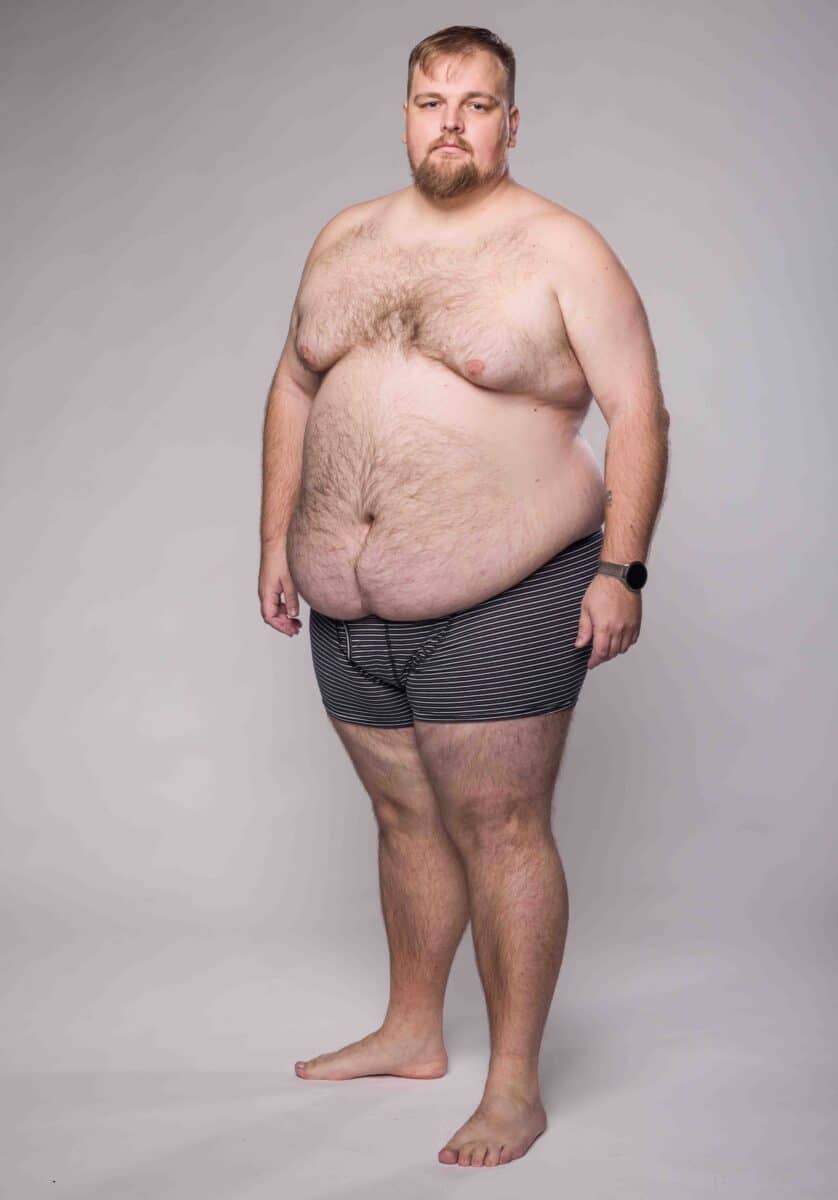 170kilový Matěj Černý v pořadu Extrémní proměny. Foto: TV Nova (se souhlasem)