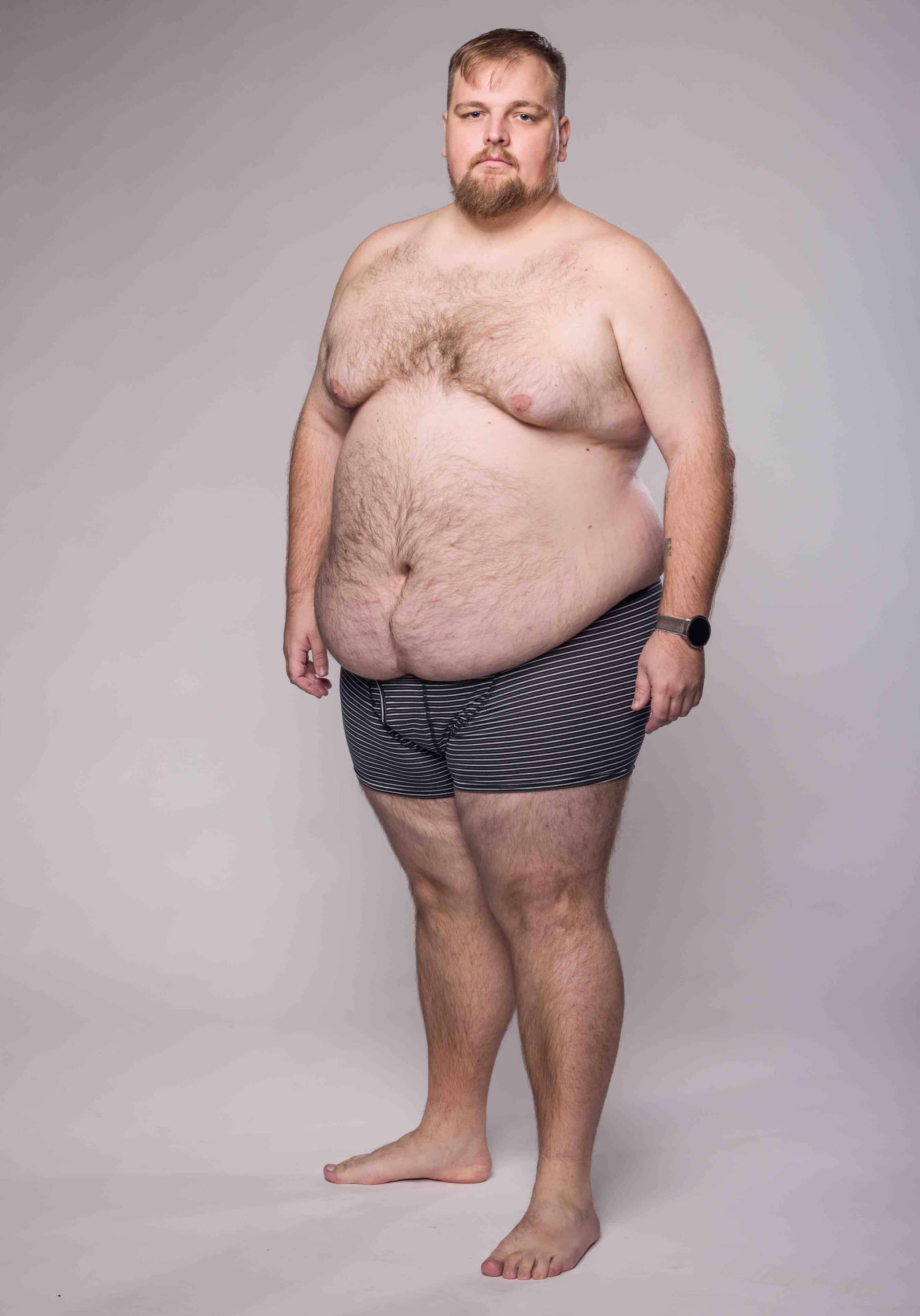 170kilový Matěj Černý v pořadu Extrémní proměny. Foto: TV Nova (se souhlasem)