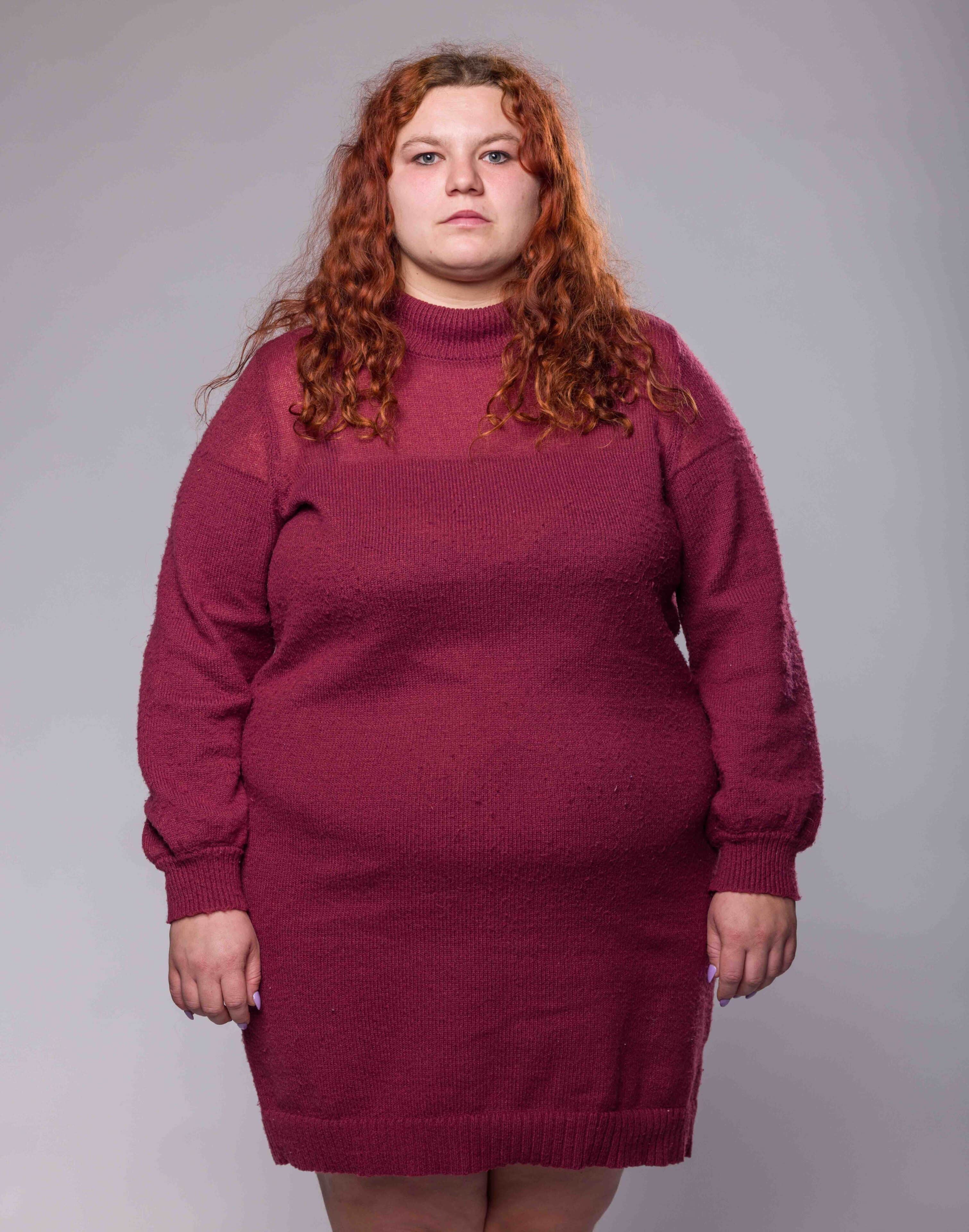 Na začátku Karolina vážila 125 kilo. Foto: TV Nova